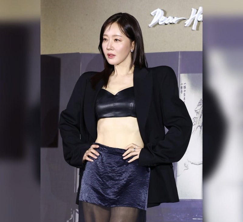 The daily look shown by the spirited actress who even underwent surgery for a serious fracture after her shoe got caught in a manhole while traveling!